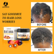 Fast Hair Growth Oil