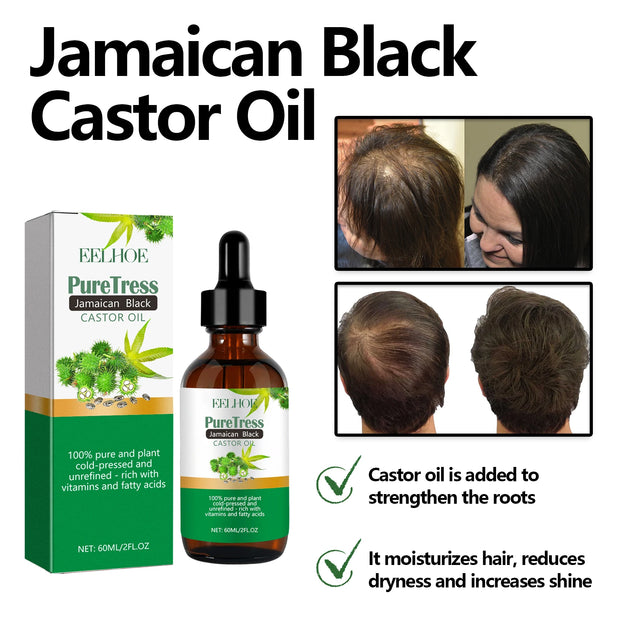 Castor Scalp
